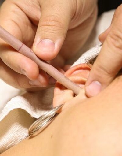 EAR CANDLE TREATMENT